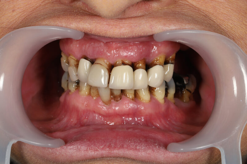 Before - Cheadle Hulme Dental