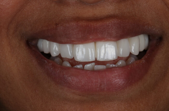 After - Cheadle Hulme Dental