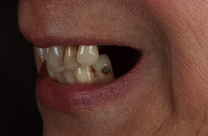 Before - Cheadle Hulme Dental