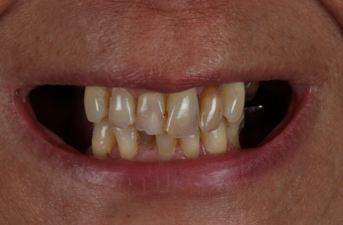 Before - Cheadle Hulme Dental