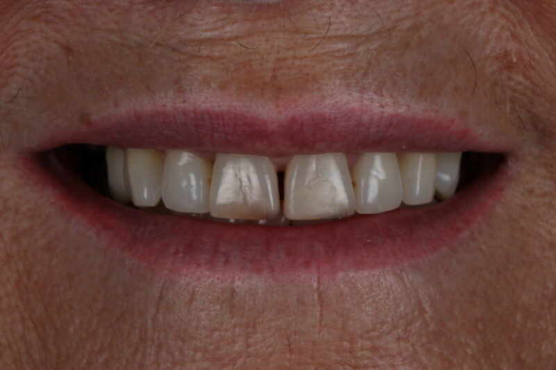 Before - Cheadle Hulme Dental