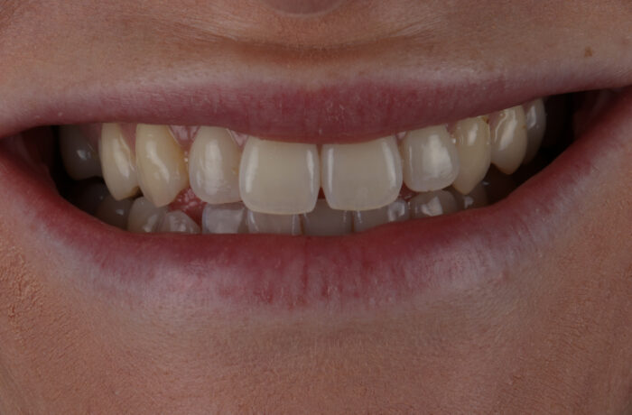 Before - Cheadle Hulme Dental