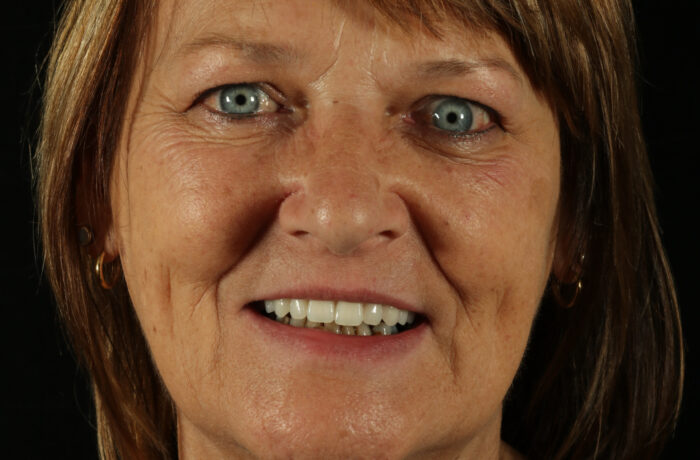 After - Cheadle Hulme Dental