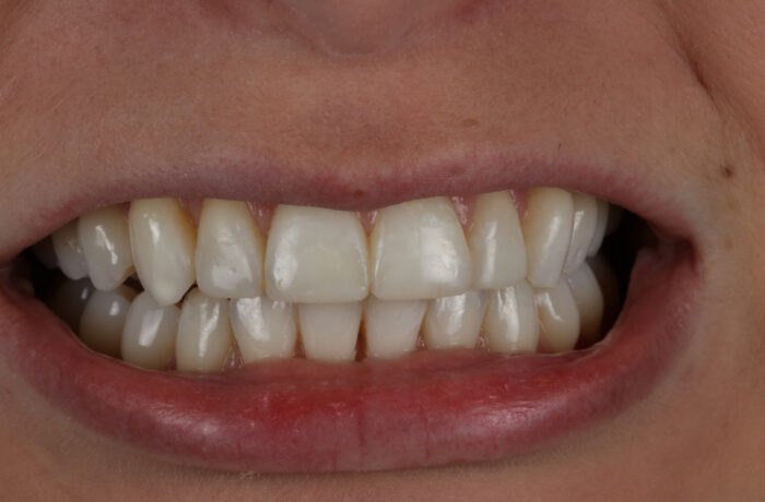 After - Cheadle Hulme Dental