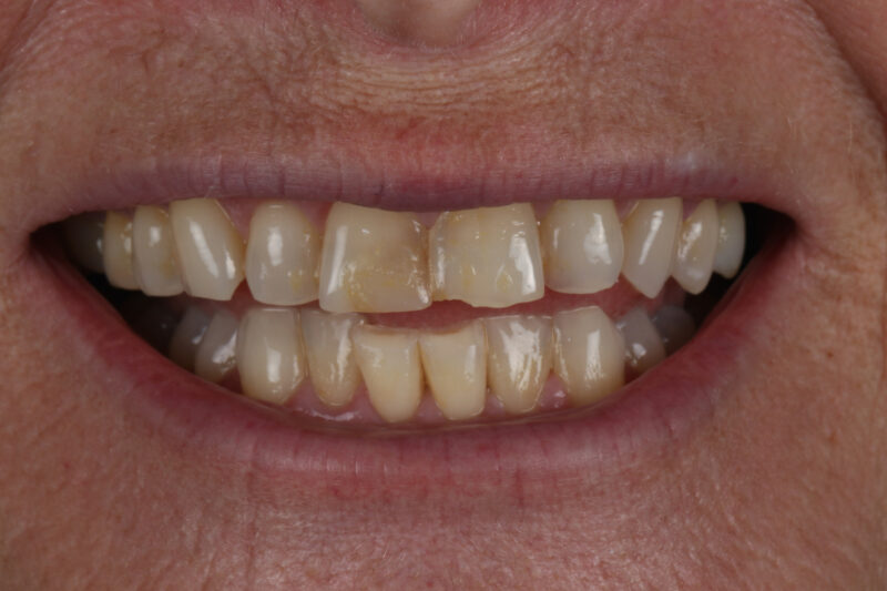 Before - Cheadle Hulme Dental