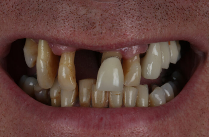 Before - Cheadle Hulme Dental