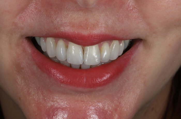 After - Cheadle Hulme Dental