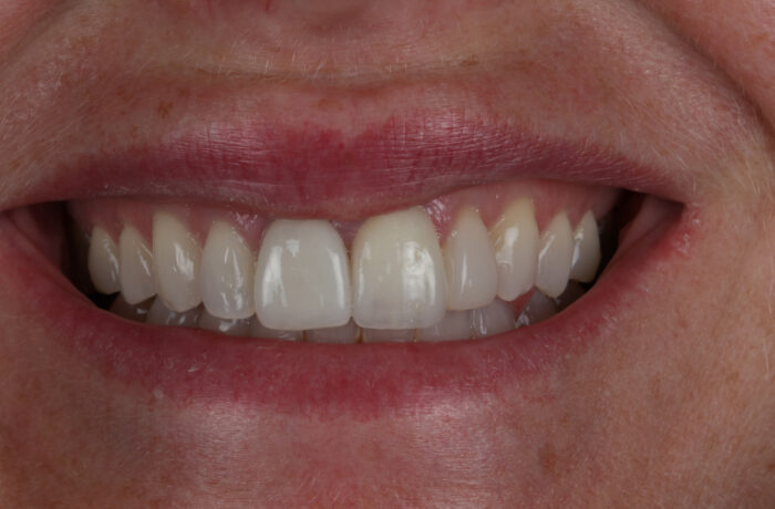 After - Cheadle Hulme Dental