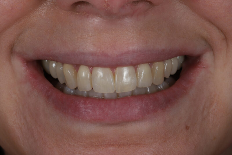 After - Cheadle Hulme Dental