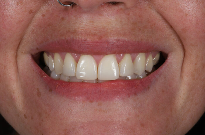 After - Cheadle Hulme Dental