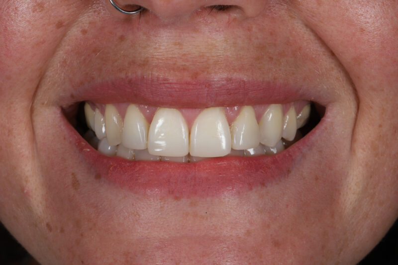 After - Cheadle Hulme Dental