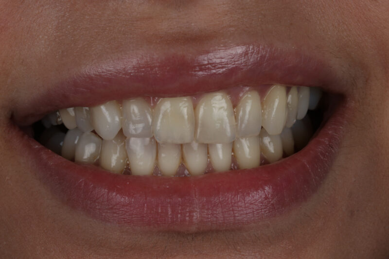 Before - Cheadle Hulme Dental