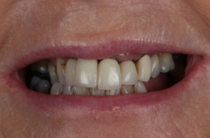 Before - Cheadle Hulme Dental