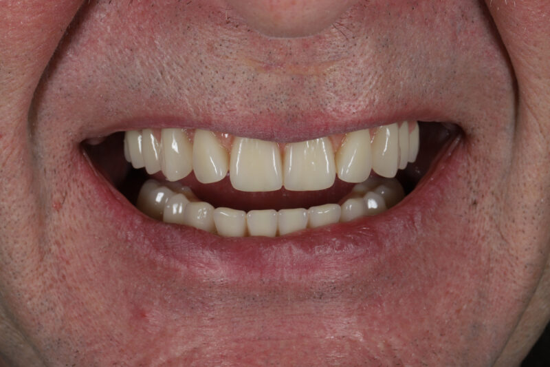 After - Cheadle Hulme Dental