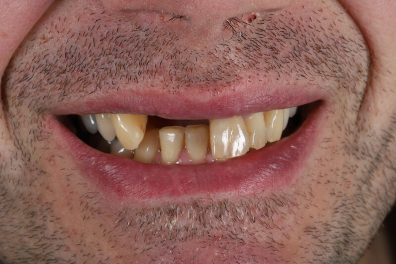 Before - Cheadle Hulme Dental