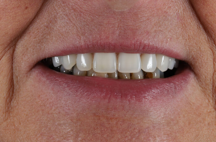 After - Cheadle Hulme Dental