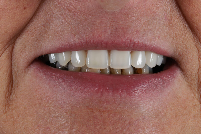 After - Cheadle Hulme Dental