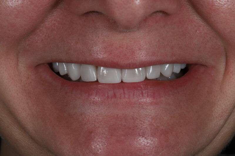 After - Cheadle Hulme Dental