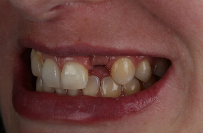 Before - Cheadle Hulme Dental