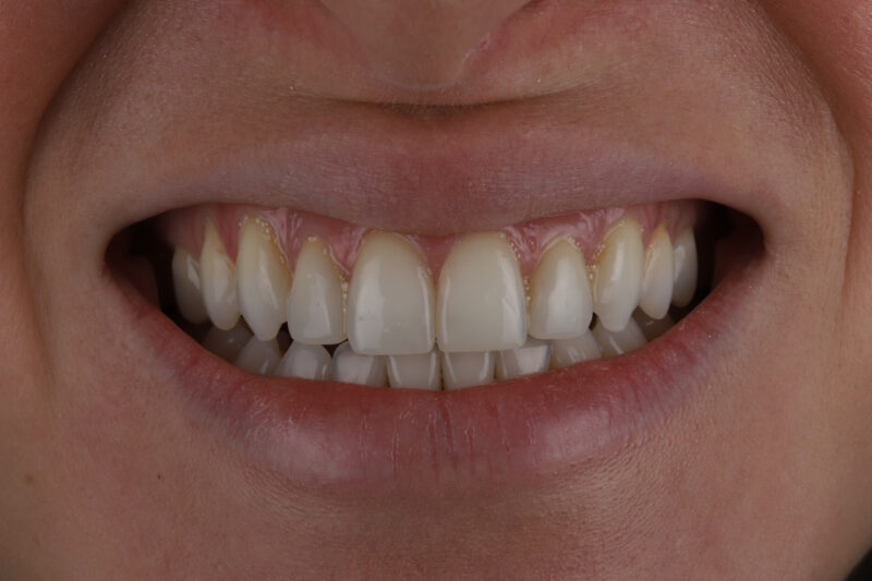 After - Cheadle Hulme Dental