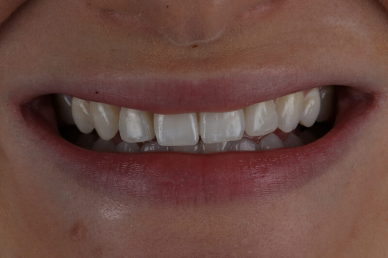 After - Cheadle Hulme Dental