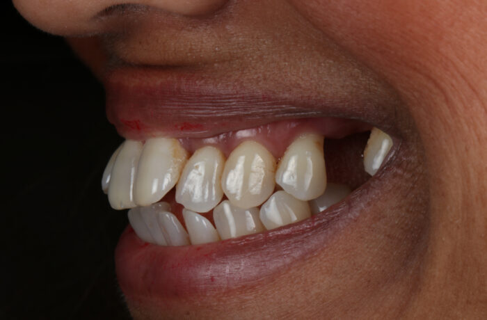 Before - Cheadle Hulme Dental