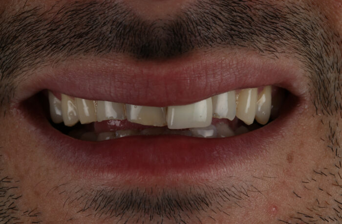 Before - Cheadle Hulme Dental