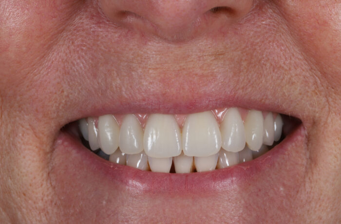 After - Cheadle Hulme Dental