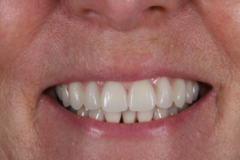 After - Cheadle Hulme Dental