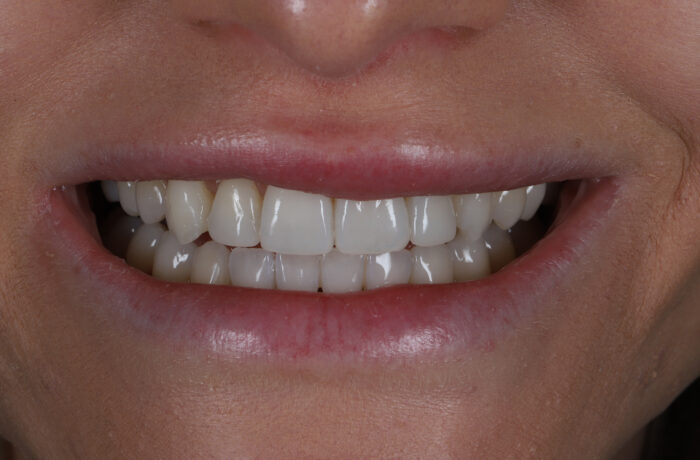 After - Cheadle Hulme Dental