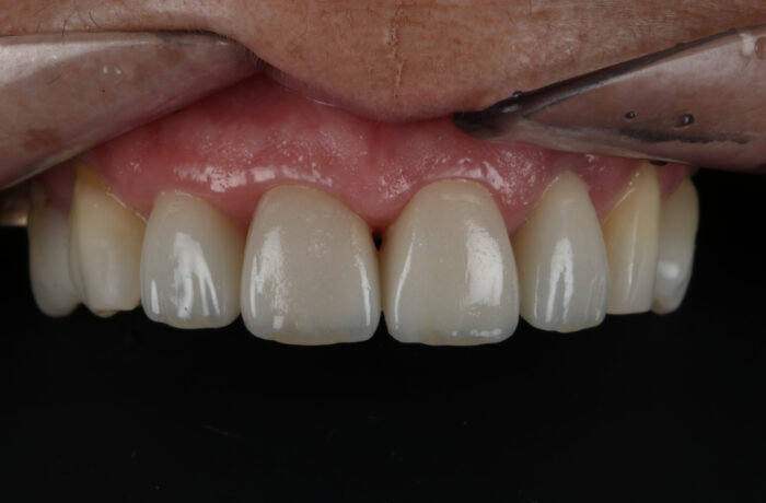 After - Cheadle Hulme Dental