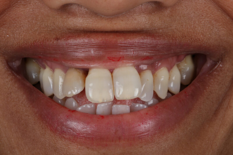 Before - Cheadle Hulme Dental