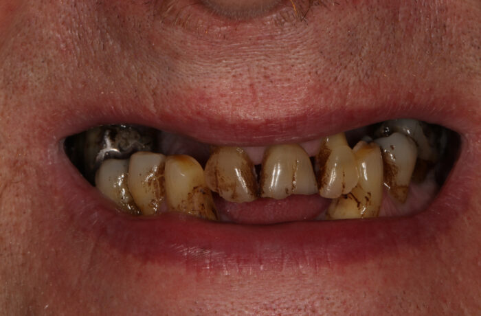 Before - Cheadle Hulme Dental