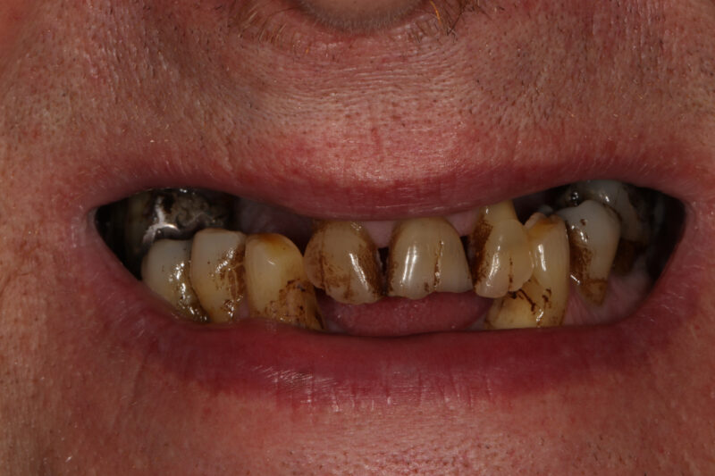 Before - Cheadle Hulme Dental