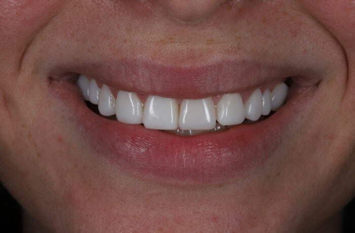 After - Cheadle Hulme Dental