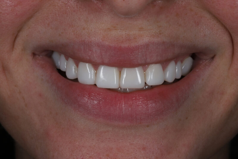 After - Cheadle Hulme Dental