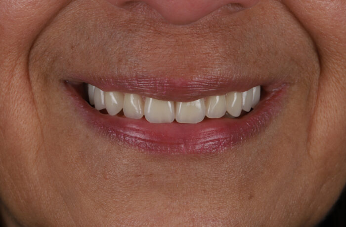 After - Cheadle Hulme Dental