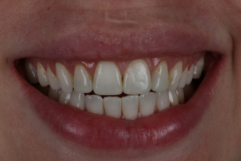 After - Cheadle Hulme Dental