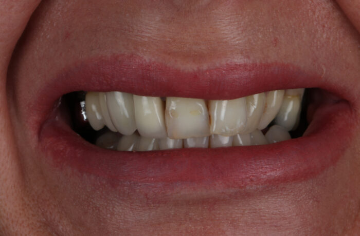 Before - Cheadle Hulme Dental