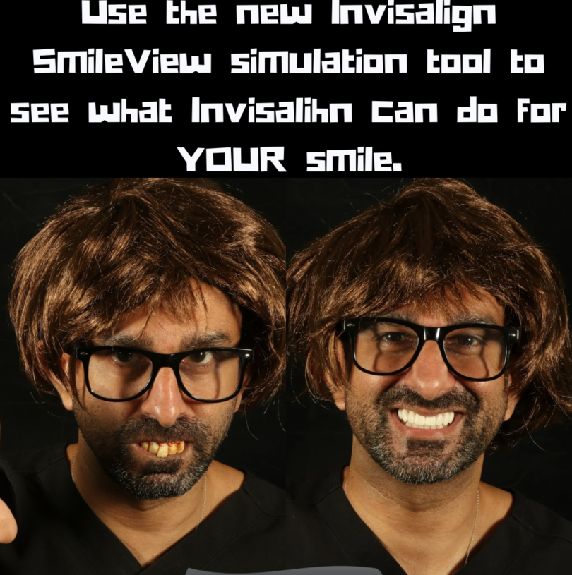 INVISALIGN SMILE SIMULATION