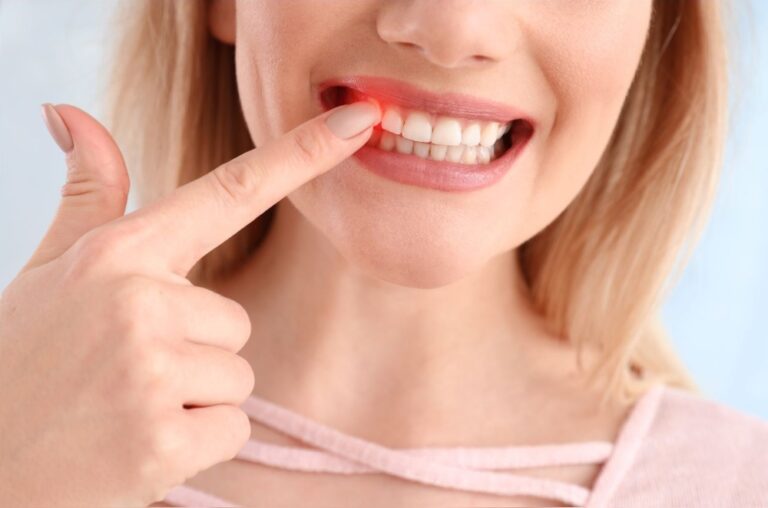 Tooth Discolouration After Trauma – What Are My Options?