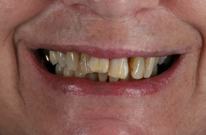 Before - Cheadle Hulme Dental