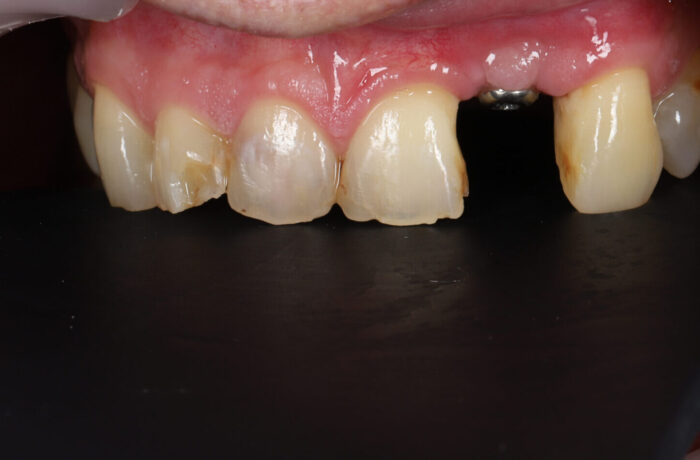 Before - Cheadle Hulme Dental