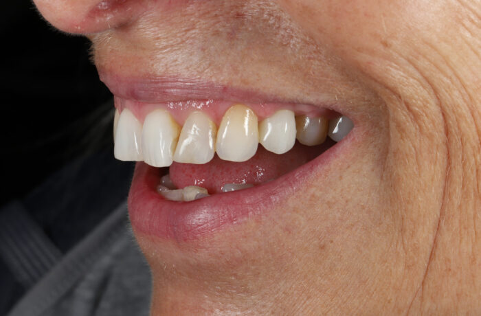 After - Cheadle Hulme Dental