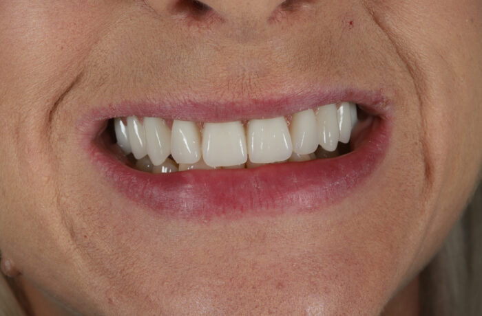 After - Cheadle Hulme Dental