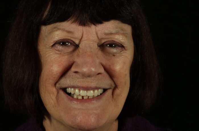 After - Cheadle Hulme Dental