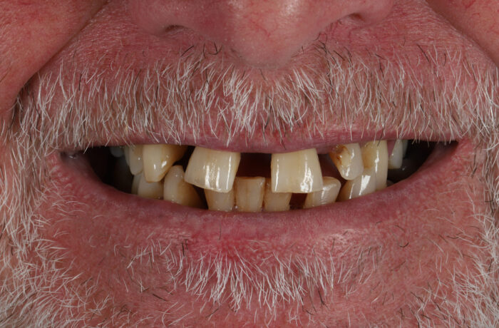 Before - Cheadle Hulme Dental