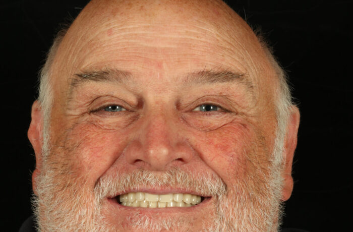 After - Cheadle Hulme Dental