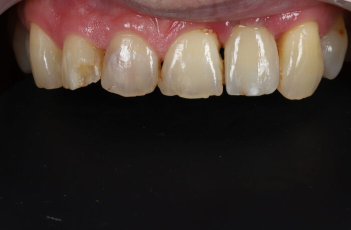After - Cheadle Hulme Dental
