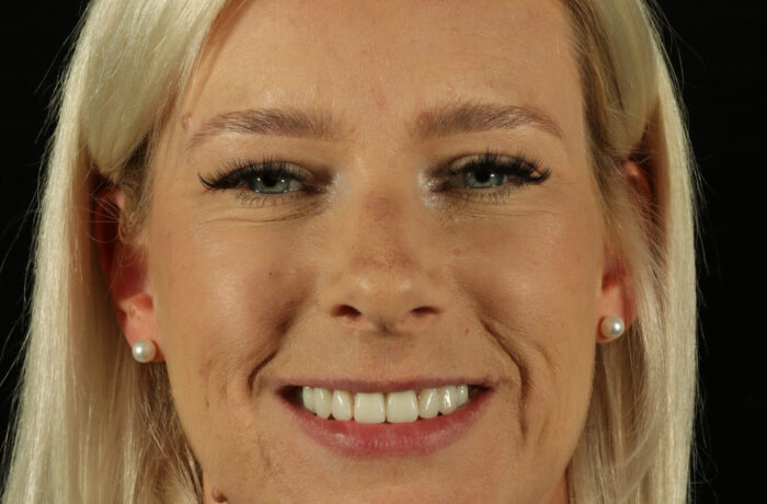 After - Cheadle Hulme Dental